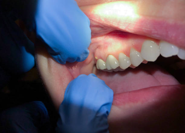 Best Urgent Tooth Repair  in Ripley, MS