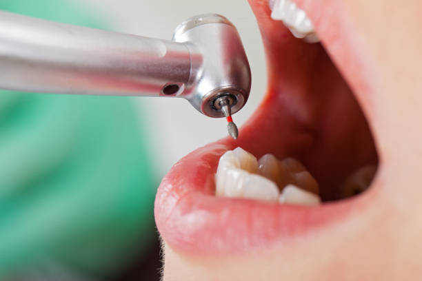 Best Root Canal Emergency Dentist  in Ripley, MS